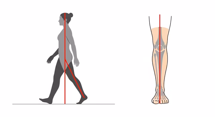 A person demonstrating correct walking form, with an upright posture and their knee aligned directly over their second toe.